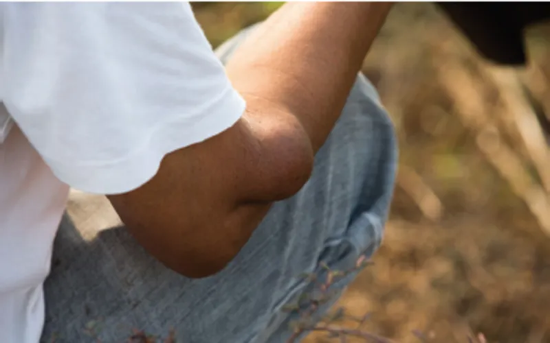 Lithotripsy Center for Kidney Stones